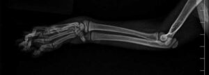 xray-of-cat's-leg