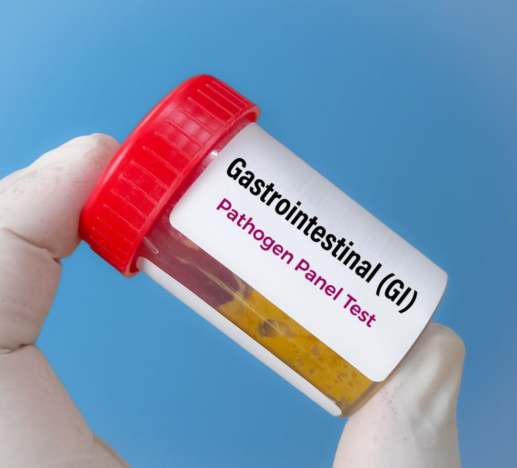 Giardia Test
